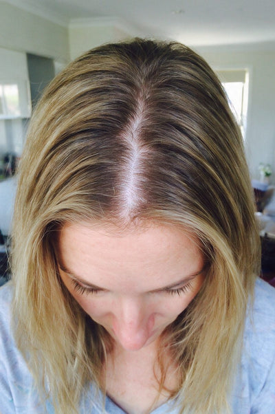 After photo, Chloe W · 29 · Seattle WA