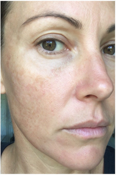 After photo, Nadia H · 45 · Bethesda MD